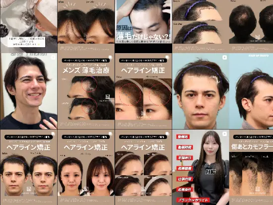 InstagramやTikTokで症例やクリニックの雰囲気などの情報を発信中！ぜひ「hairoftokyo」でご検索ください。
